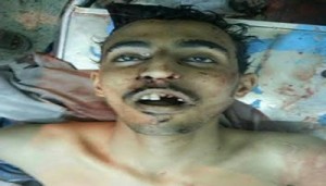 اﻻجهزة الامنية تكشف هوية الارهابي الثاني الذي الذي مصرعه مع مايسمى امير ولاية ‏صنعاء بتنظيم القاعدة